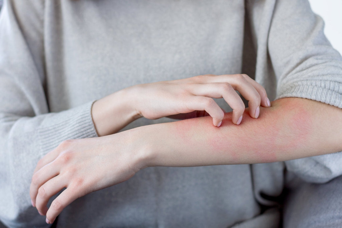 Can Wheatgrass Juice Help Heal Dermatitis? - Britt's Superfoods